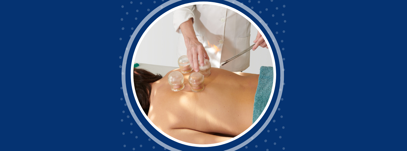 TALLER CUPPING THERAPY PARA FISIOTERAPEUTAS